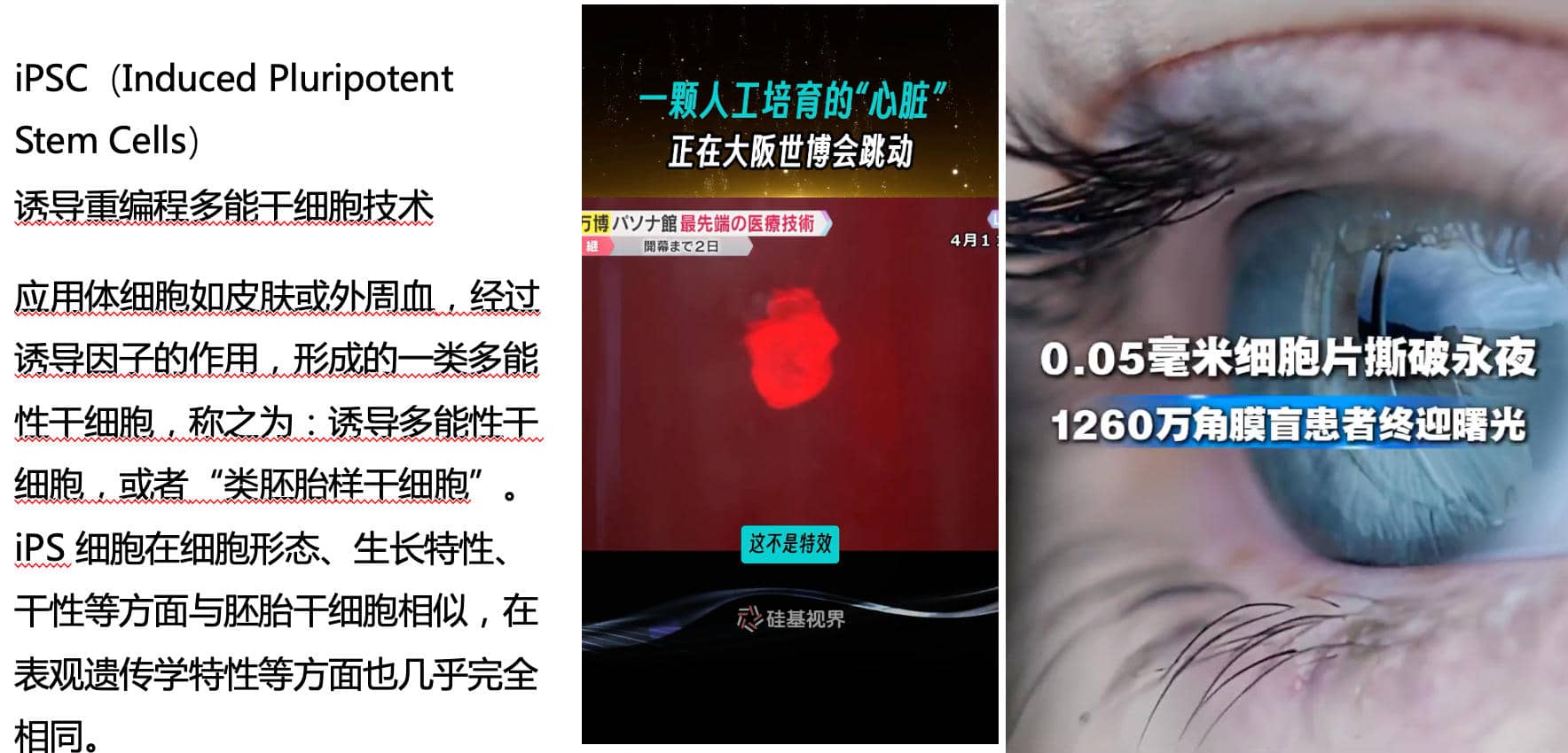 iPSC再生医学服务